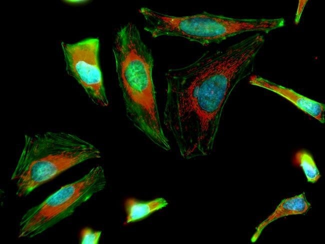 Live cell labeling with CellMask Green Actin Tracking Stain